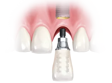 الحالات المناسبة